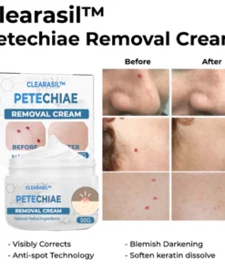 Clearasil PRO Petechiae Removal Cream