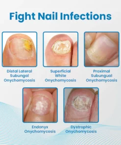 Ceoerty Anti-Paronychia Nail Treatment Gel