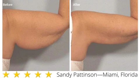 FitPlus Skin Tightening Spray