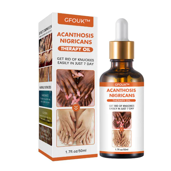 Zoviia Acanthosis Nigricans Therapy Oil