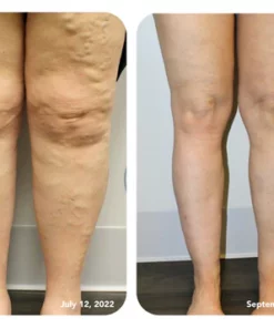 Oveallgo ULTRA DetoxingHerbs Cleansing Foot Soak Beads