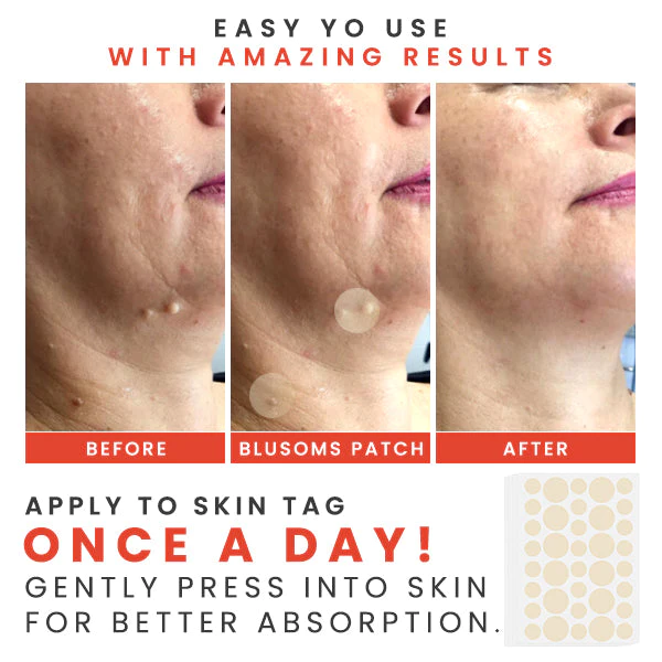 TagFix MicroDarts Spot Removal Patch