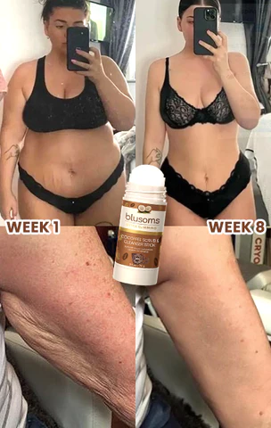 GFOUK Active Caffeine SwellEase Cream