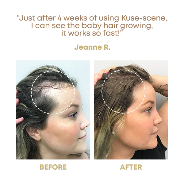 Kuse-scene RiceWater Hair SerumMist