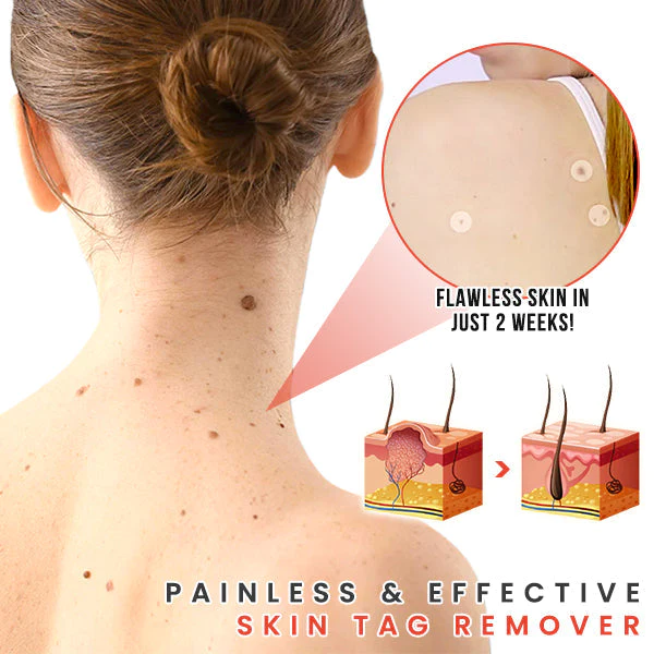 TagFix MicroDarts Spot Removal Patch