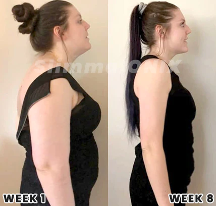 SlimmaIONIX Arm Trimmers