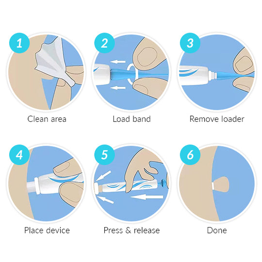 Auto-Micro Skin Tag Remover