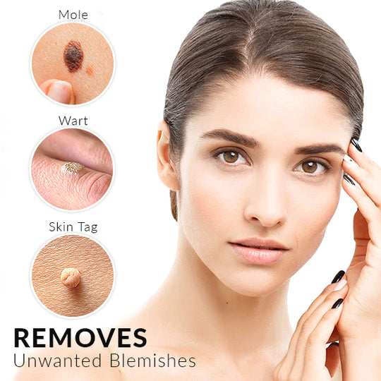 Auto-Micro Skin Tag Remover