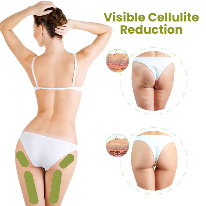 Oveallgo HerbalFirm CURE Cellulite Reduction Patches