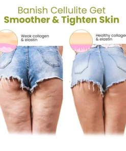 Oveallgo HerbalFirm CURE Cellulite Reduction Patches