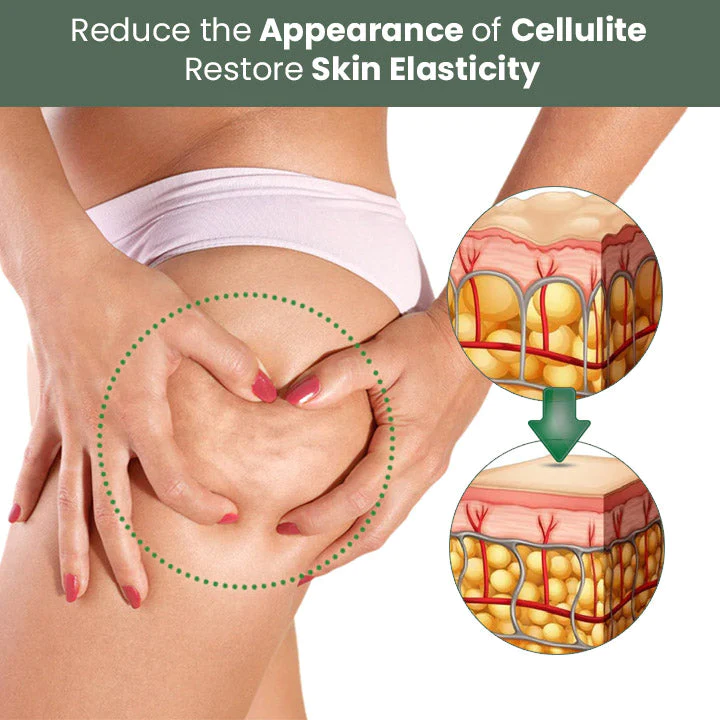 Celluzer Wormwood Cellulite Tightening Cream