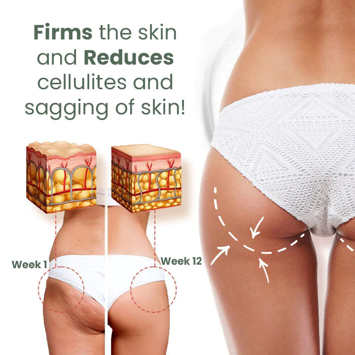 Celluzer Wormwood Cellulite Tightening Cream