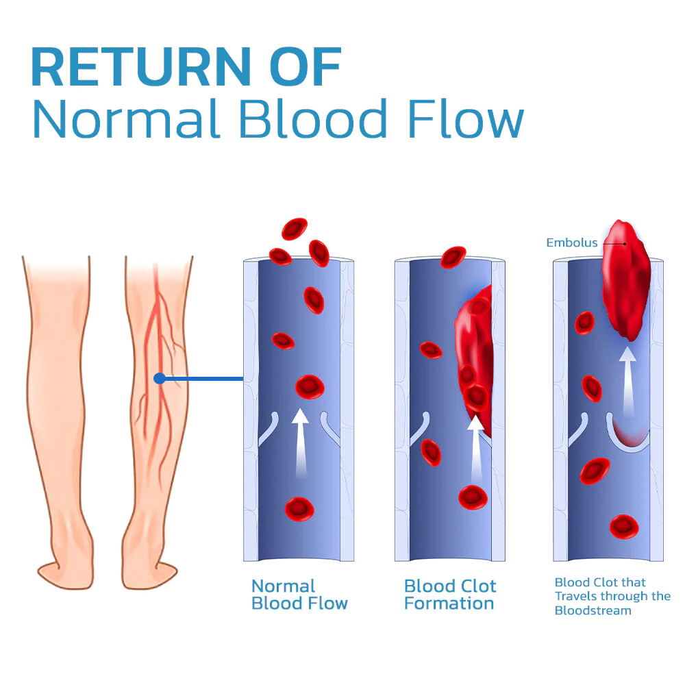 GFOUK TitanVein Far Infrared Tourmaline Acupressure Insoles