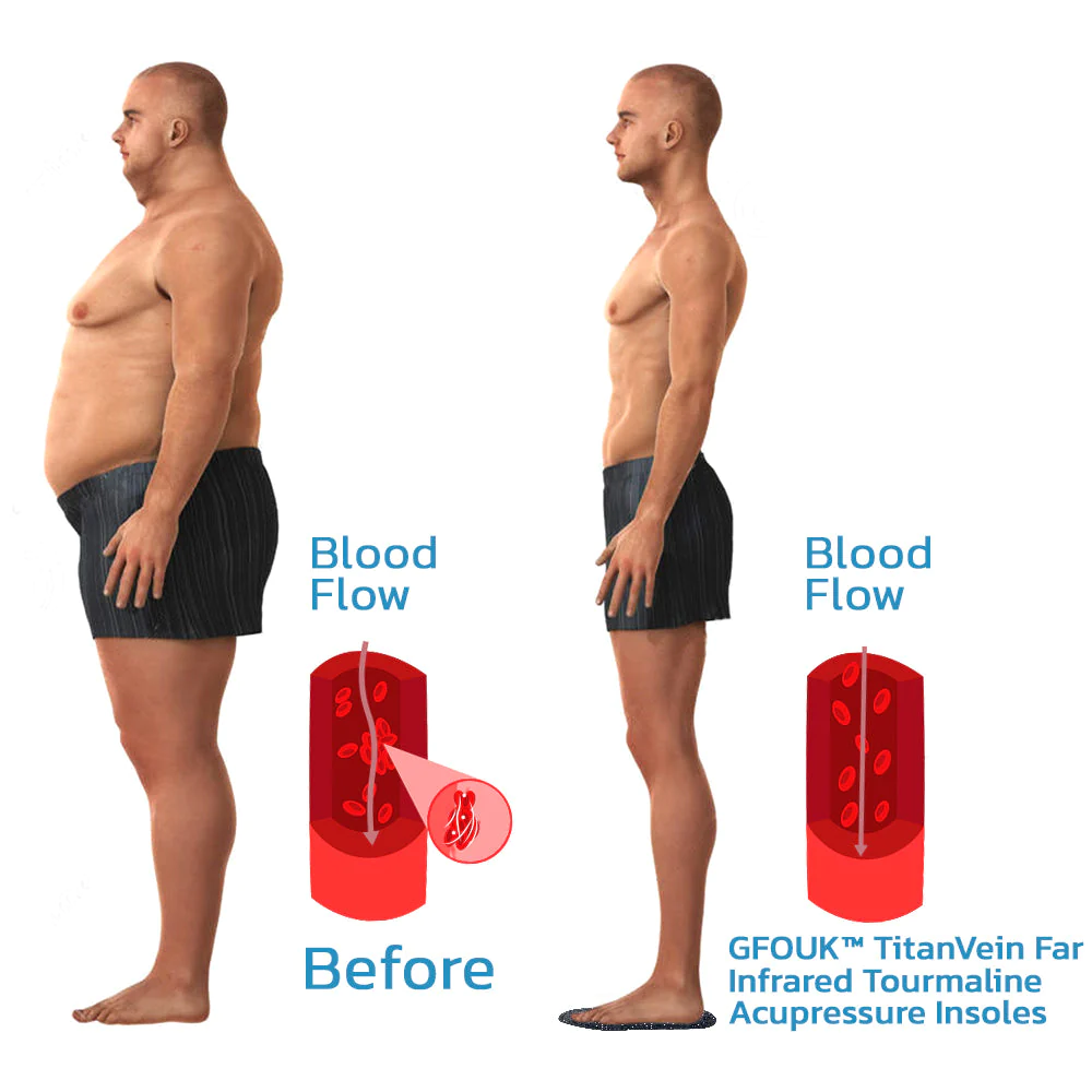GFOUK TitanVein Far Infrared Tourmaline Acupressure Insoles