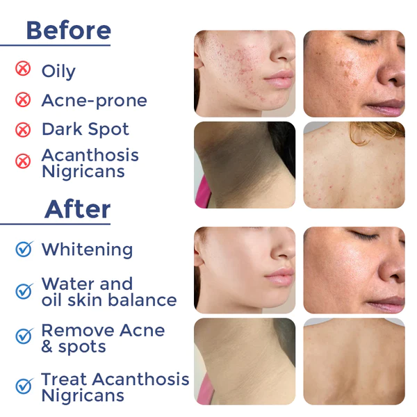 Biancat DermReborn Acne & Dark Spots Cleansing Lotion