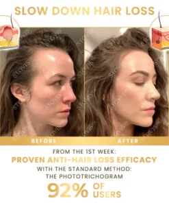 STOVIS Biotin Hair Booster