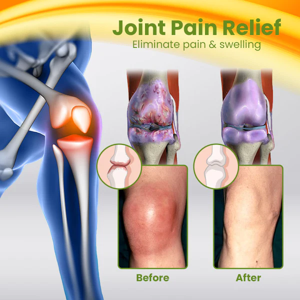 Ceoerty BEETox Joint & Bone Therapy Cream