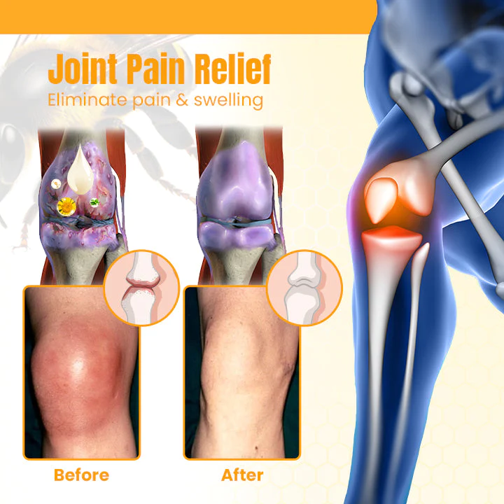 Ceoerty Bee Venom Joint & Bone Healing Cream