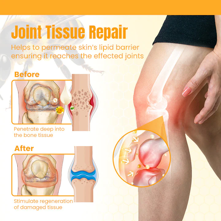 Ceoerty Bee Venom Joint & Bone Healing Cream