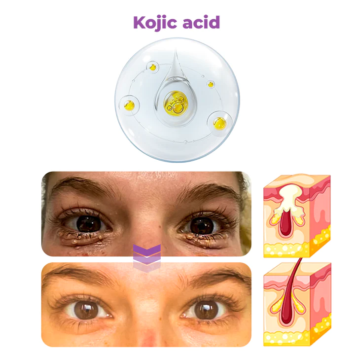 Oveallgo Milk Spots Therapy Electric Serum Pen