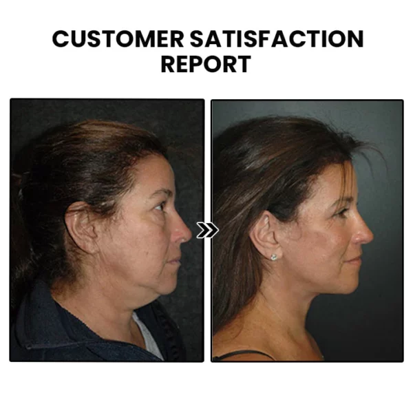 EarFit Acupressure Slimming Earrings