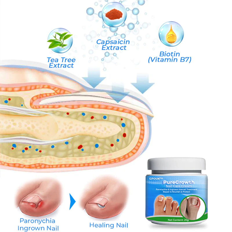 GFOUK PureGrowth Nail Care Cream