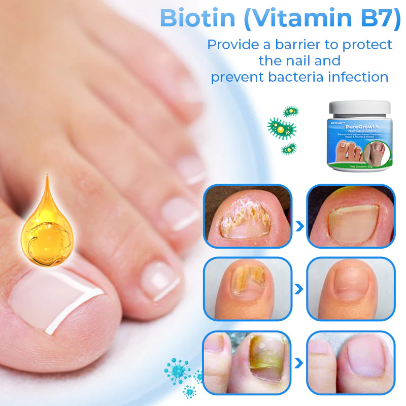 GFOUK PureGrowth Nail Care Cream