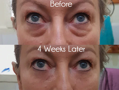 flysmus DEleventh Pro-Xylane Active Eye Cream