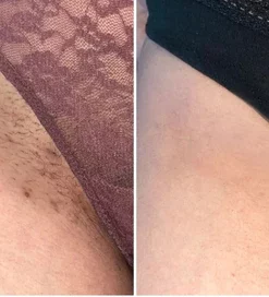 Liascy GlowBright Whitening Stick