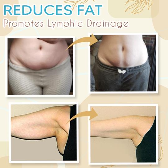 Lymphedem Detoxification Cream