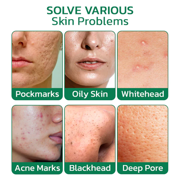 EELHOE TRUL YMI Green Tea Vitamin Detox Mask