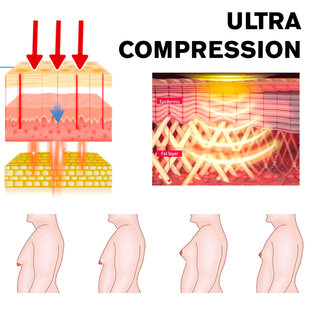 Ricpind MenGynecomastia Infrared Compression T-Shirt