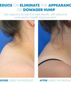 Microcurrent FastRelief Lymphvity NeckMassager