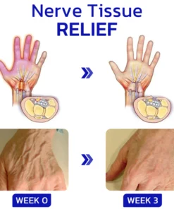 GFOUK NumbFix Hands and Foots Spray