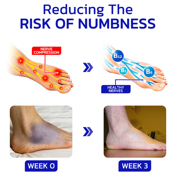 GFOUK NumbFix Hands and Foots Spray