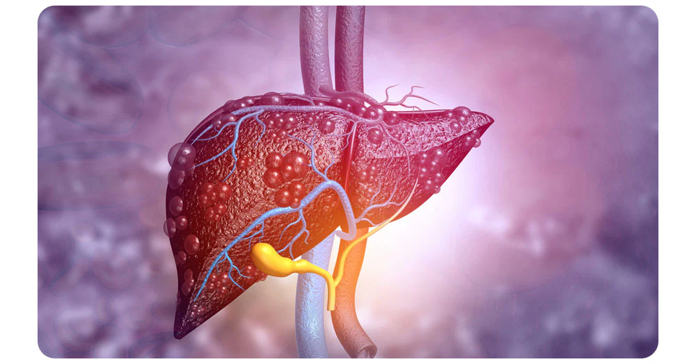 BLUESKY Liver Care Patches