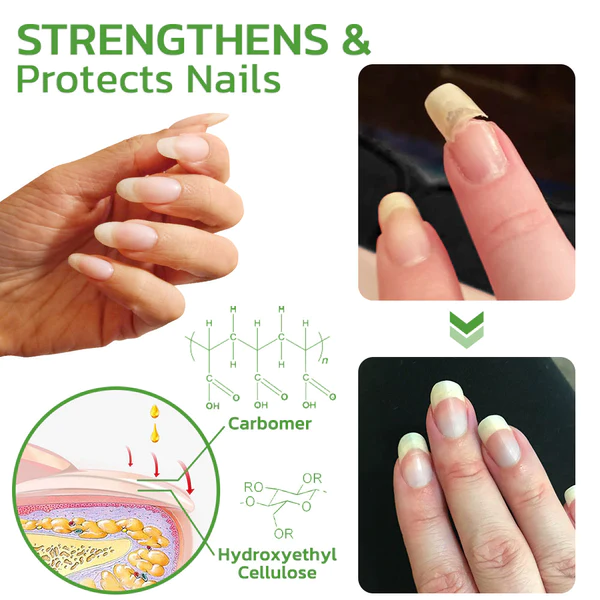 Oveallgo 5 Days Nail Growth and Hardening Repair Roller