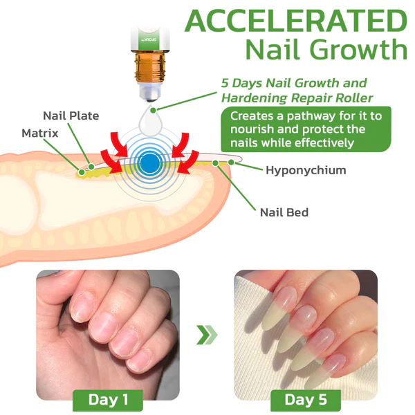 Oveallgo 5 Days Nail Growth and Hardening Repair Roller