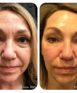 Jorondy Awaken Peptide Lifting Eye Gel