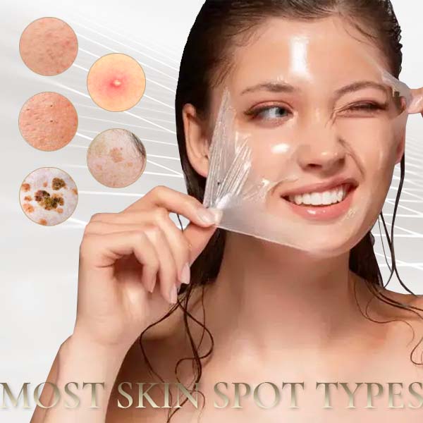 Oilex Natural Spots Whitening Yellow Peeling Oil