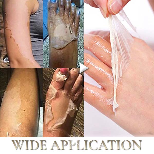 Oilex Natural Spots Whitening Yellow Peeling Oil