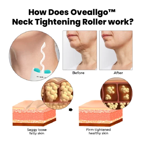 Oveallgo Neck Tightening Roller