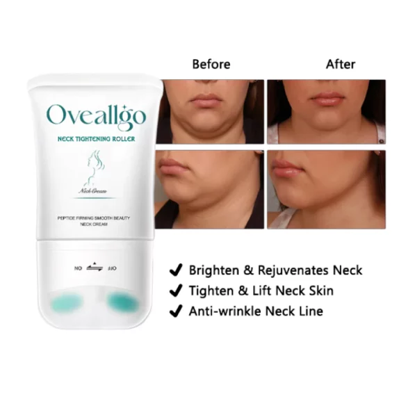 Oveallgo Neck Tightening Roller