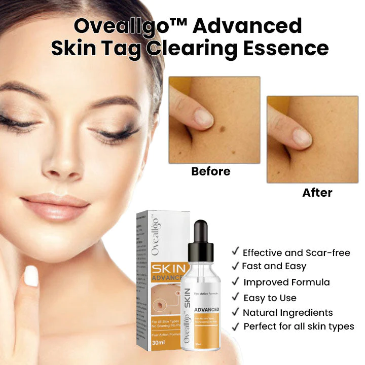 Oveallgo Advanced Skin Tag Clearing Essence