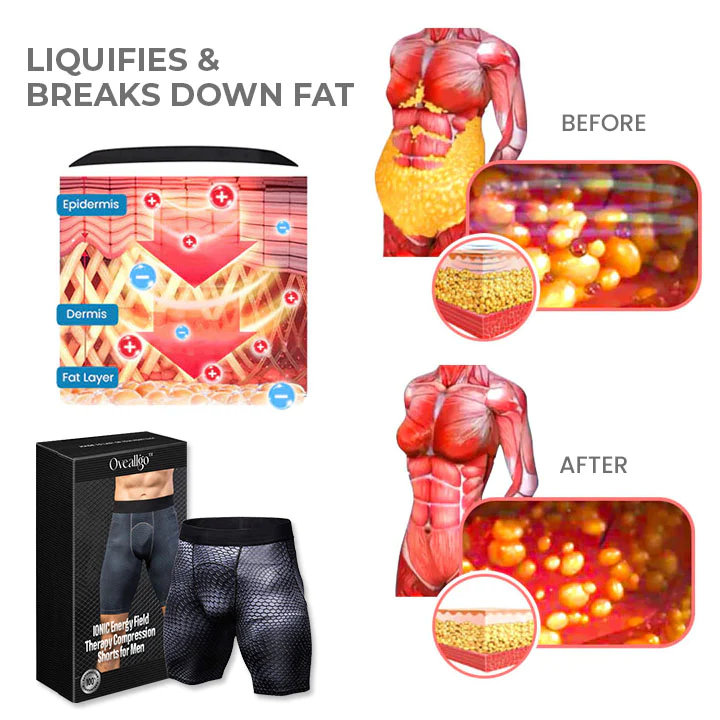 Oveallgo IONIC Energy Field Therapy Compression Shorts for Men