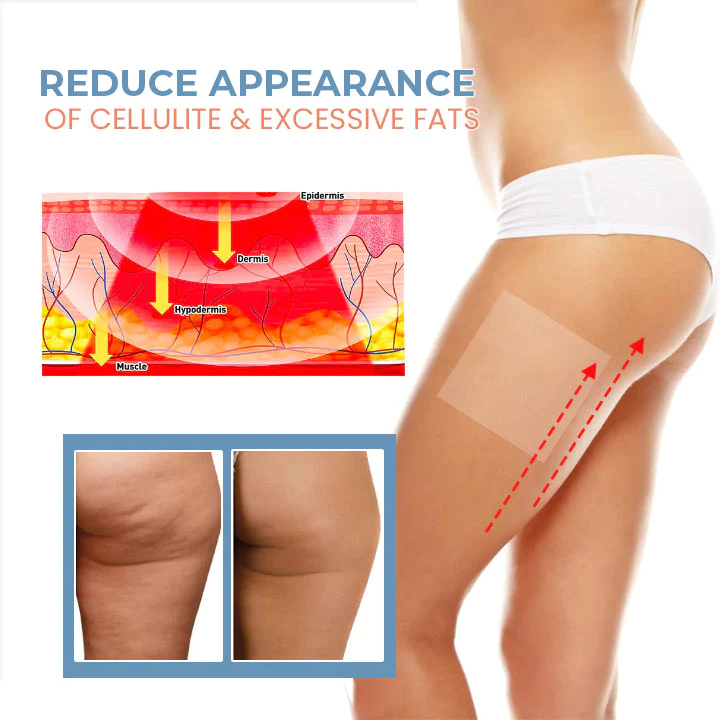 Seurico TightenCell Anti-Cellulite Collagen Firming Patches