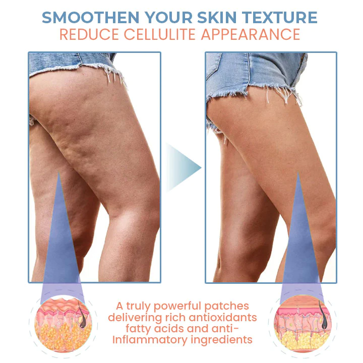 Seurico TightenCell Anti-Cellulite Collagen Firming Patches