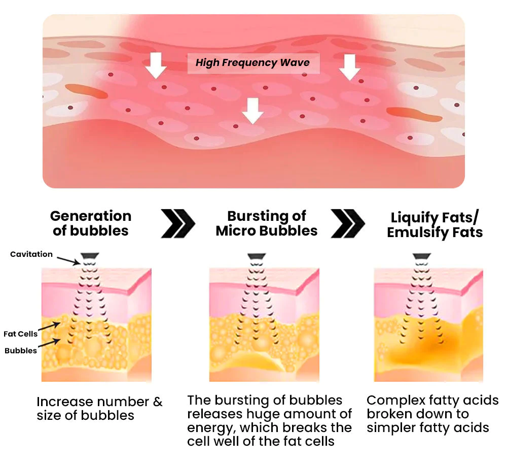 Ceoerty FitFlex High-Frequency Body Sculpt Band