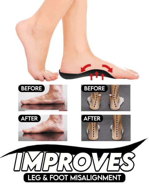 Flat Foot Orthopedic Insoles