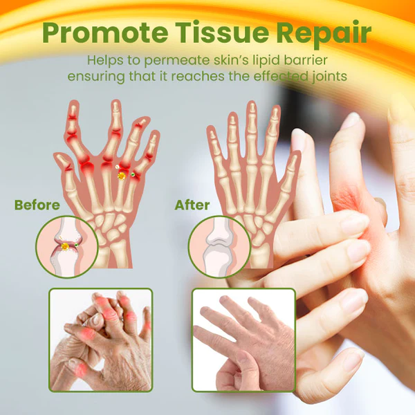 Ceoerty BEETox Joint & Bone Therapy Cream